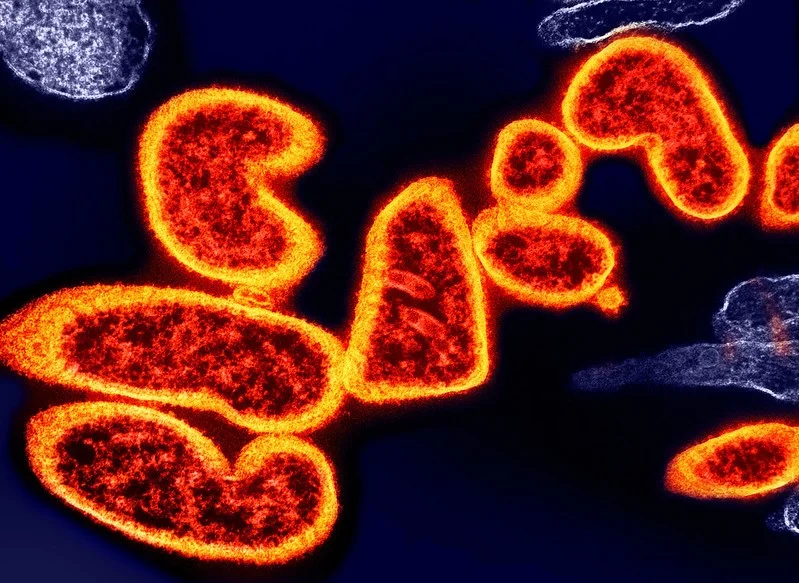 Nipah virus infections in India's Kerala state rise to 5 | CIDRAP